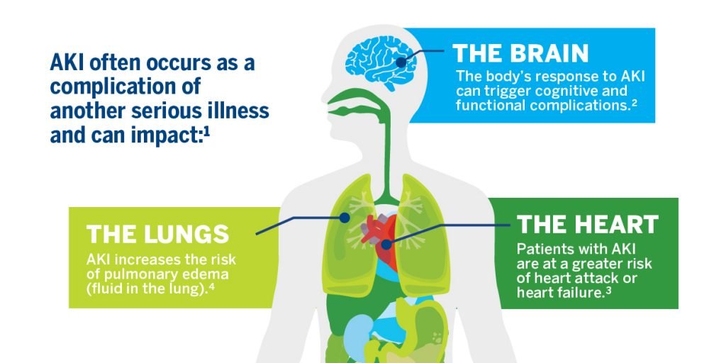 Aki Hayakawa In Mashle Explained Character Background And Abilities